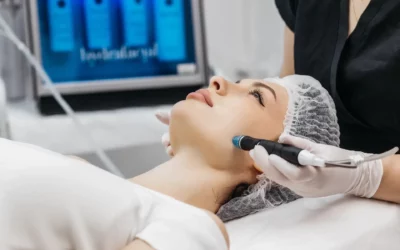 Épilation laser du visage chez la femme : précautions pour une épilation du visage dans la Meuse